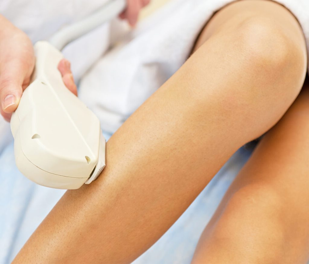 laser hair removal NJ
